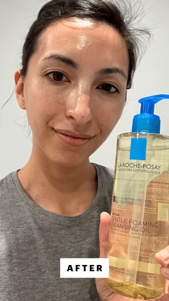 Pai after using LaRoche Posay's Lipikar AP Gentle Foaming Cleansing Oil
